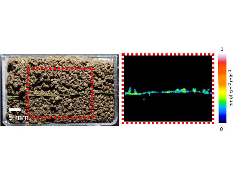 computerized zymography image